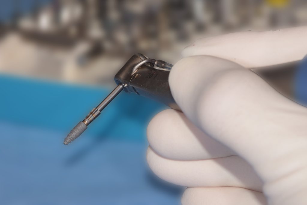 Implant dentaire périgueux